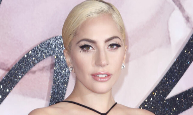 image: Lady Gaga: - Jeg lider av en alvorlig sykdom